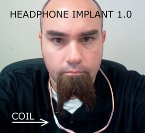 Homem com bobina ao pescoço, conceito de implante fone de ouvido 1.0. Para ímãs na orelha e outras aplicações.