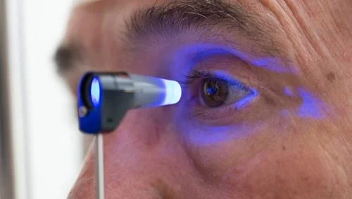 Oftalmoscópio com luz azul em exame ocular. Auxiliar no diagnóstico de glaucoma.