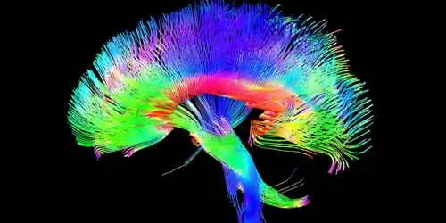 Ímãs podem melhorar seu cérebro?